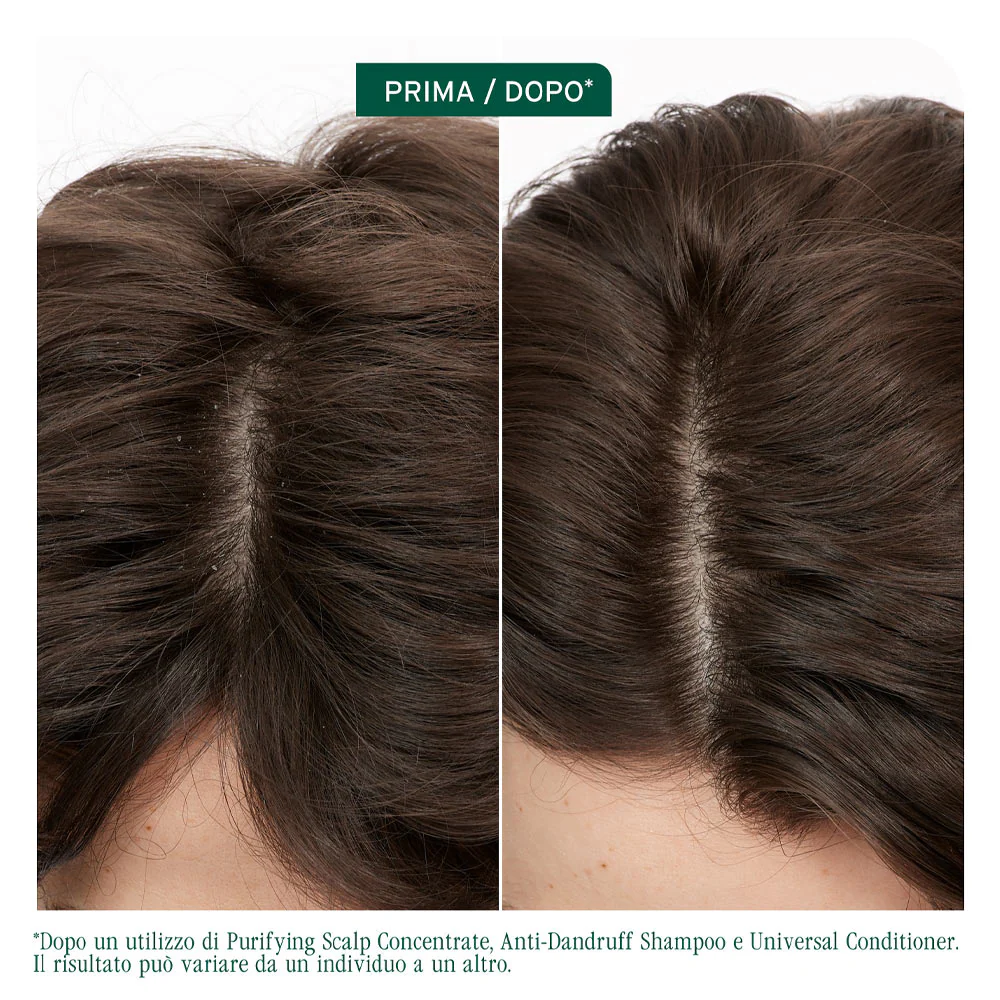 Biolage Professional Hai Spa Scalp Sync Anti-Dandruff Shampoo 400ml - shampoo anti forfora - Image 4
