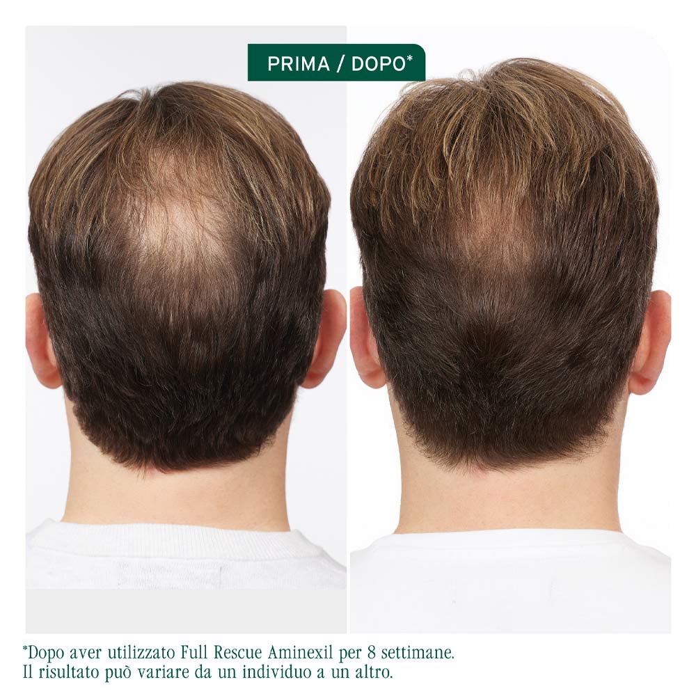 Biolage Professional Hair Spa Full Rescue Aminexil 6x10ml - fiale anti caduta - Image 3