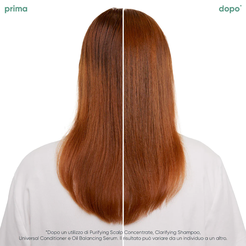Biolage Scalp Sync Oil Balancing Serum 50ml - siero per cuoio capelluto grasso - Image 2