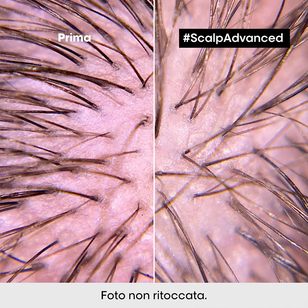 L'Oreal Professionel Scalp Advanced Anti-Discomfort Intense Soother 200ml - trattamento lenitivo - Image 3