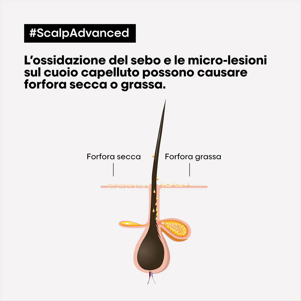 L'Oreal Professionnel Paris Scalp Advanced Anti-Dandruff Shampoo 300ml - shampoo anti forfora - Image 2