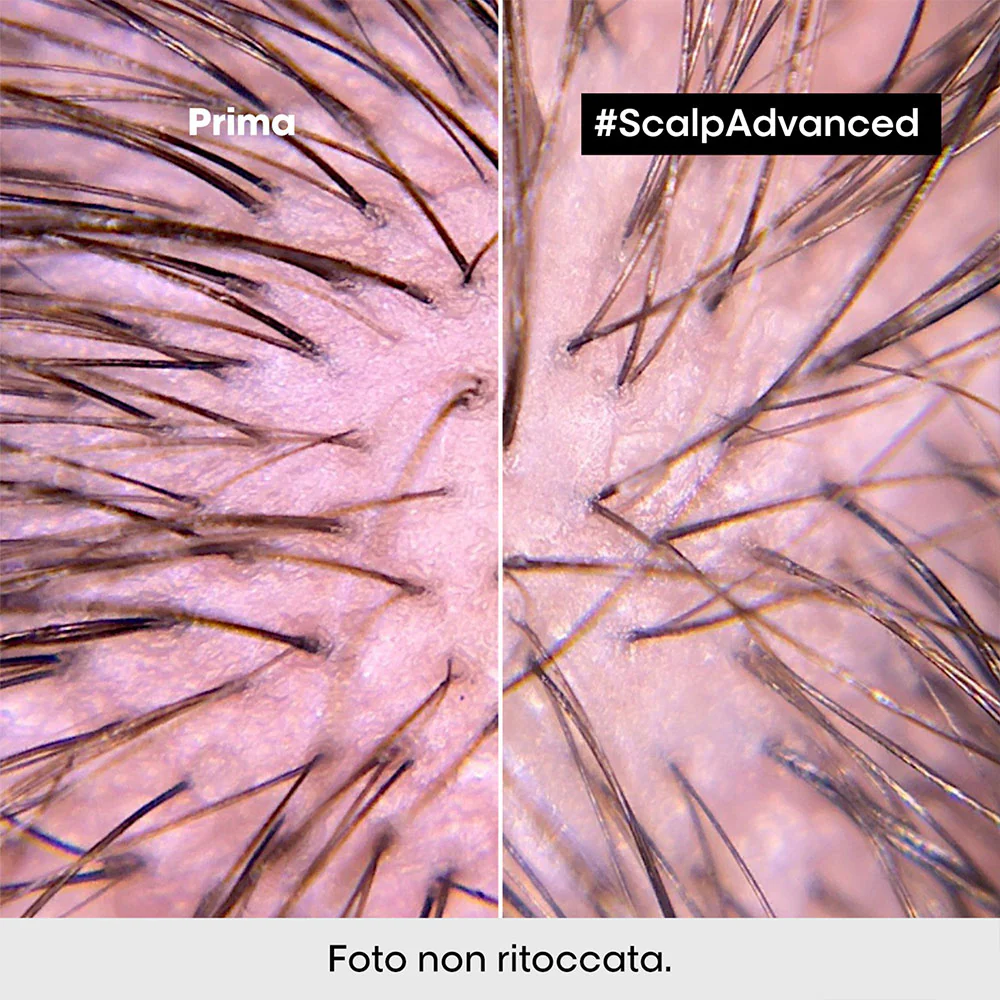 L'Oreal Professionnel Paris Scalp Advanced Anti-Discomfort Shampoo 500ml - shampoo lenitivo - Image 3