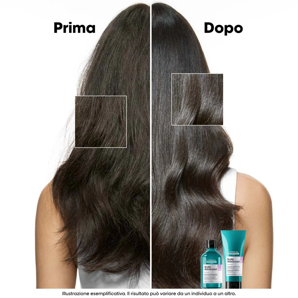 L'Oreal Professionnel Paris Scalp Advanced Anti-Discomfort Shampoo Refill 500ml - eco-ricarica shampoo lenitivo - Image 3