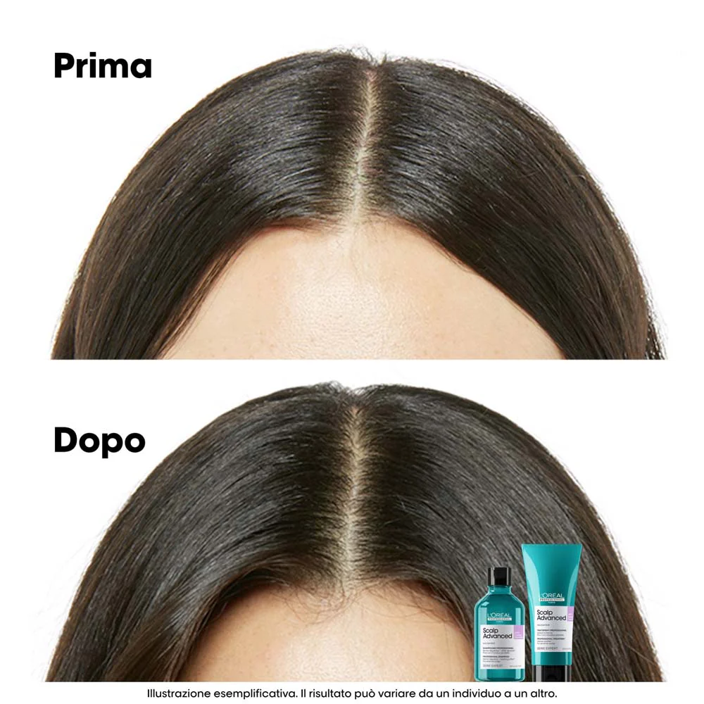 L'Oreal Professionnel Paris Scalp Advanced Anti-Discomfort Shampoo Refill 500ml - eco-ricarica shampoo lenitivo - Image 4