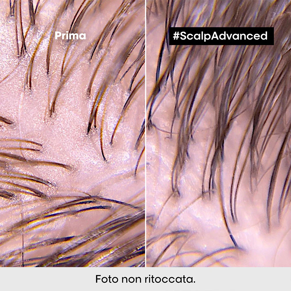 L'Oreal Professionnel Paris Scalp Advanced Anti-Oiliness 2in1 Deep Purifier Clay 250ml - shampoo & maschera purificante - Image 3