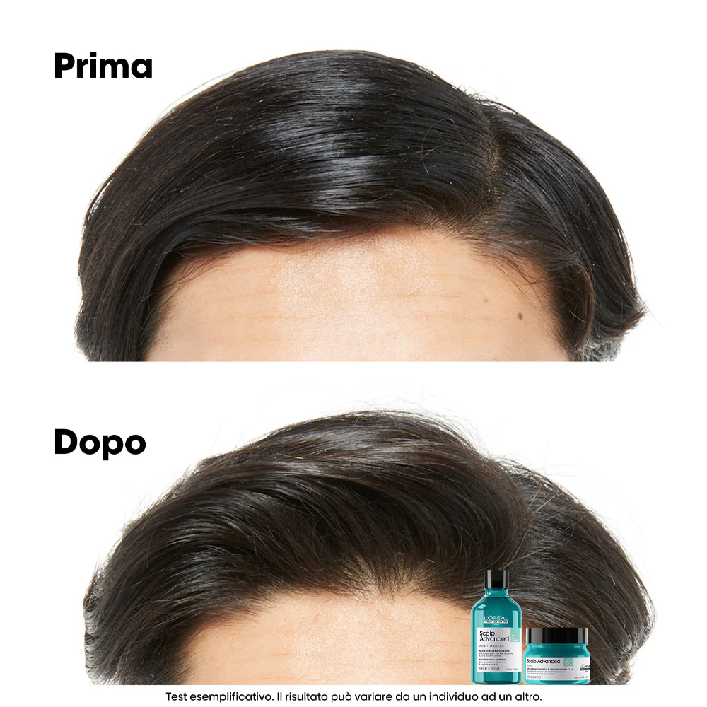 L'Oreal Professionnel Paris Scalp Advanced Anti-Oiliness Shampoo 500ml - shampoo sebo regolarizzatore - Image 4