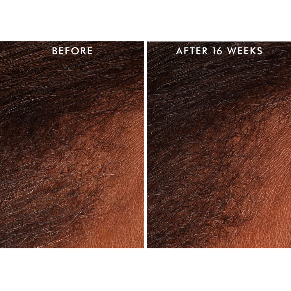 Moroccanoil Scalp Revitalizing Tonic Scalp 100ml - tonico rivitalizzante cuoio - Image 4