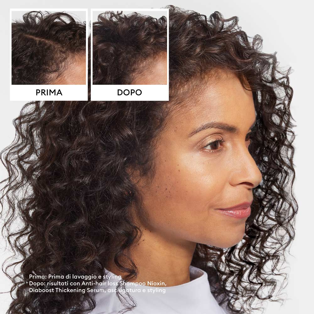 Nioxin Anti Hair Loss Shampoo 240ml - shampoo anticaduta - Image 5